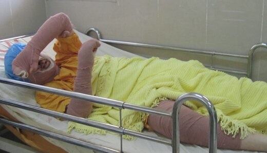 &laquo;دختر آبی&raquo; درگذشت