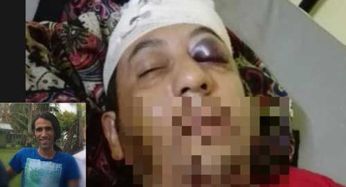 حمله پناهجوی ایرانی در استرالیا