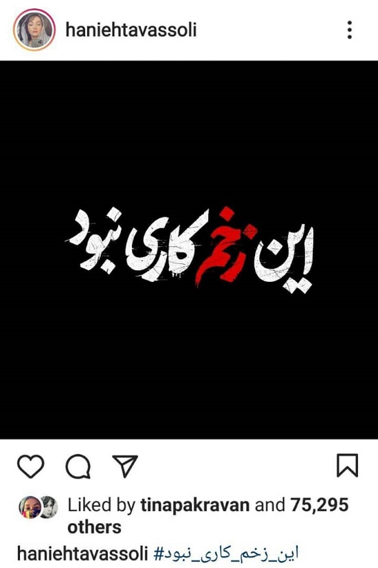 واکنش جدید هانیه توسلی به سانسور &laquo;زخم کاری&raquo;