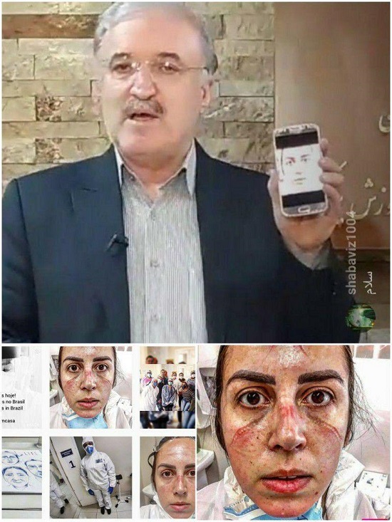 گاف تصویری وزیر بهداشت!